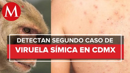 ¿Viruela del mono se contagia por aire? Esto dicen los CDC