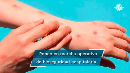 Viruela del mono: analizan caso sospechoso en Tamaulipas