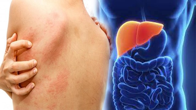 स्किन के रंग में ऐसा बदलाव है खतरनाक,भूलकर भी न करें नजरअंदाज । Boldsky