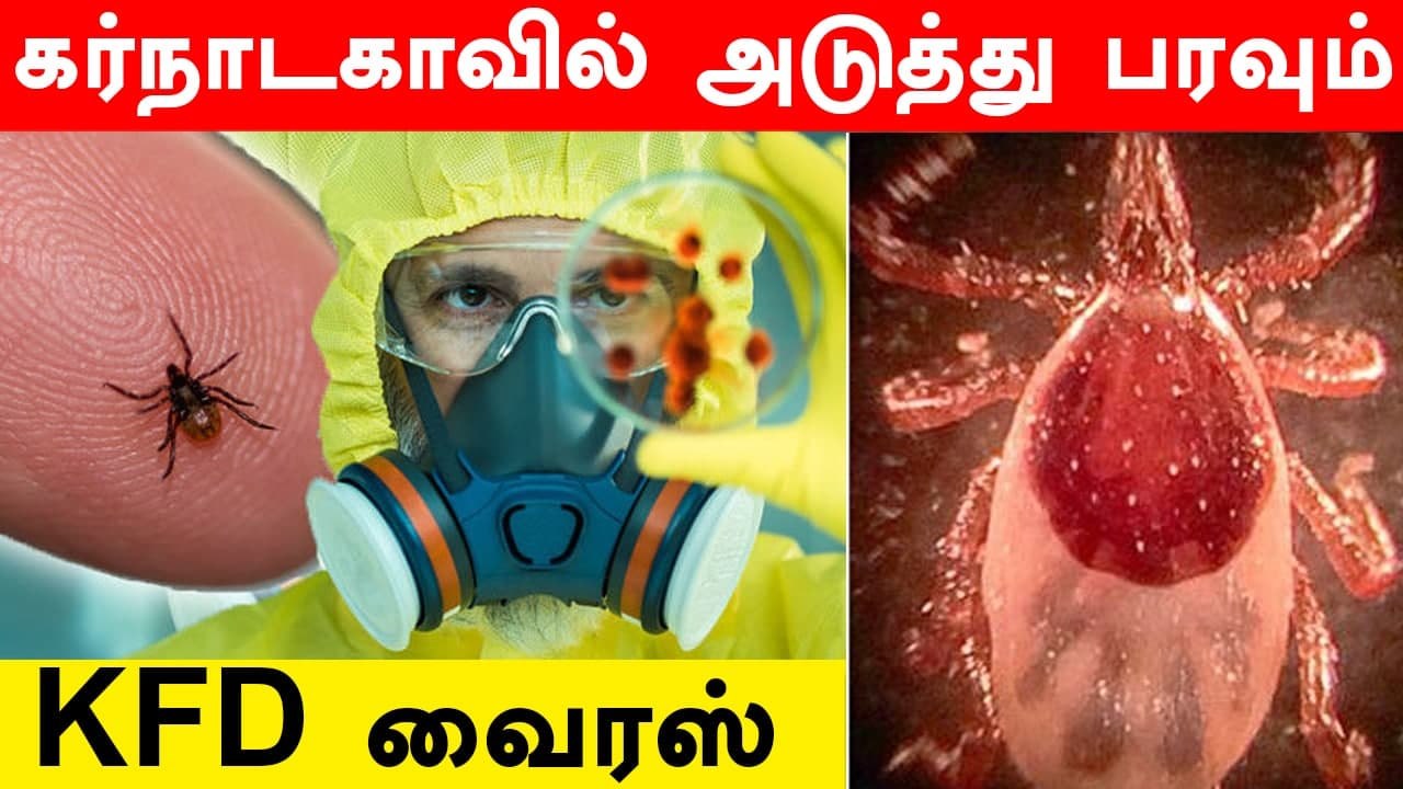 Karnataka Confirms First Positive KFD Case After 2 Years