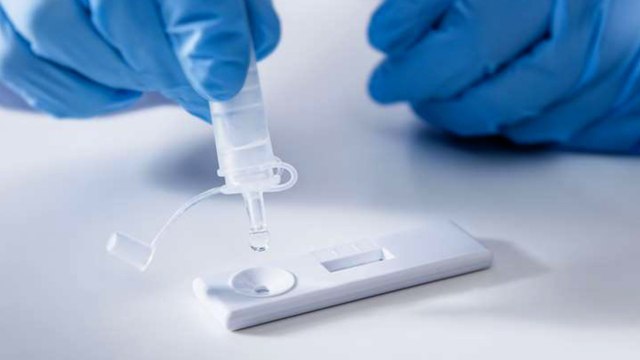 COVID-19 tests for fully vaccinated travellers arriving in Kent and the rest of the country will soon be scrapped