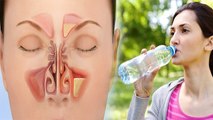 कम पानी पीने से नाक में दर्द क्यों होता है, कारण चौंकाने वाला | Boldsky