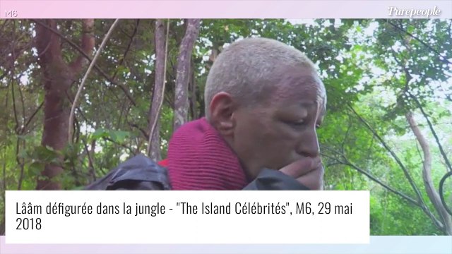 Lââm sans perruque ni chapeau : rares photos d'elle au naturel