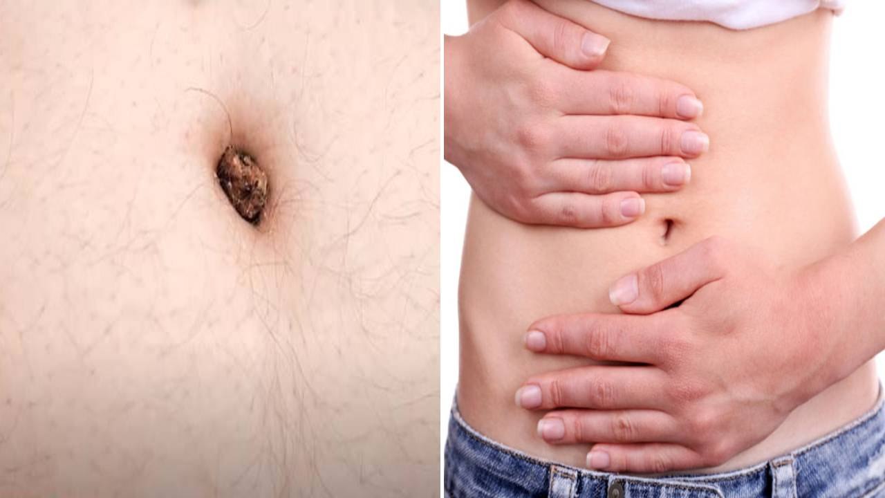 Belly Button में ये 1 Problem से होती है बीमारि...