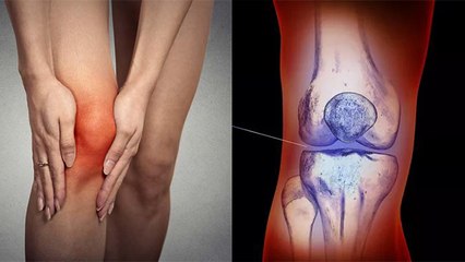 Knee Grease Problem का रामबाण इलाज,1 Month में दिखेगा फर्क|Boldsky