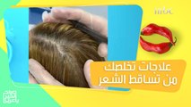 علاجات تجميلية تنهي مشكلة تساقط الشعر!