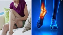 पैरों में बेचनी होना, Vitamin Deficiency से लेकर Restless Leg Syndrome का खतरा | Boldsky