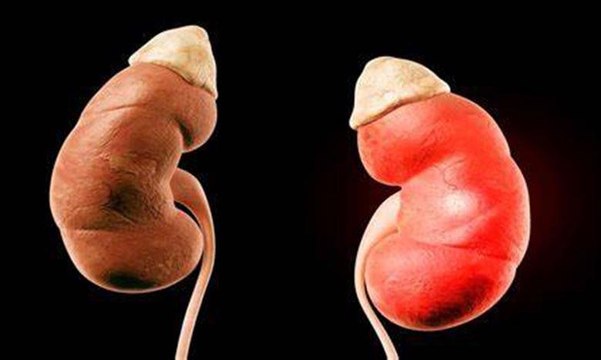 زرع كليتين حيوانيتين معدلتين وراثياً في جسم إنسان بعد نجاح عملية زراعة القلب