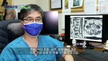 [HOT] How to treat spinal diseases., MBC 다큐프라임 220123