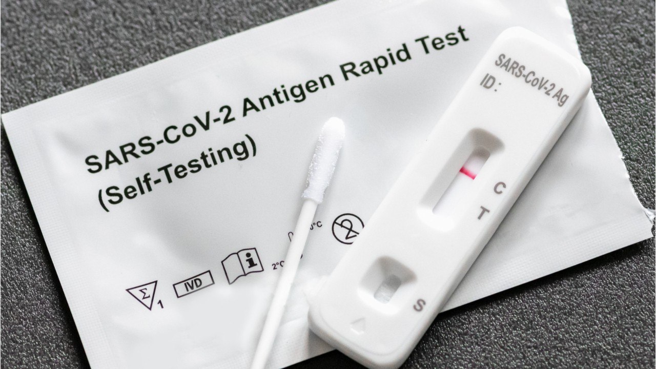 Covid-19 : les basses températures pourraient fausser les résultats des tests antigéniques