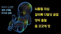 [더뉴스] 학대 의심 부모가 연명치료 중단 결정...생후 2개월 아이 사망 / YTN