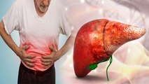 Liver Fibrosis होने का क्या कारण है, जाने Symptoms और Treatment | Boldsky