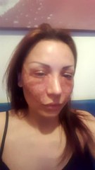 Bulgar modelin estetik davasında kuaför kardeşler 'iftira' dedi