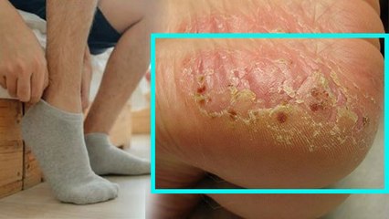 इस तरह से मौजे पहना खतरनाक, Numbness से लेकर Low Blood Pressure का खतरा | Boldsky