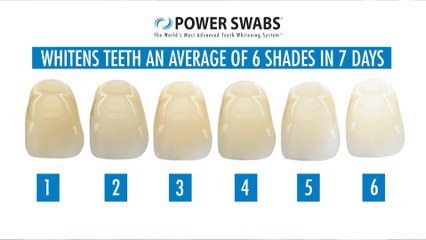 Get Your Brightest Smile Yet with the Power Swabs Daily Mix Special