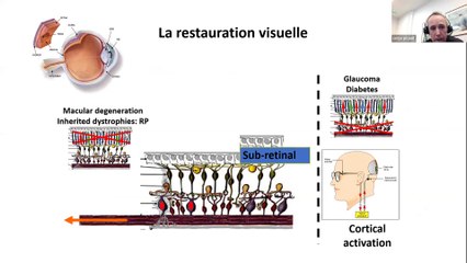 OPECST : Les progrès récents des technologies au service de la prise en charge du handicap  - Jeudi 27 janvier 2022