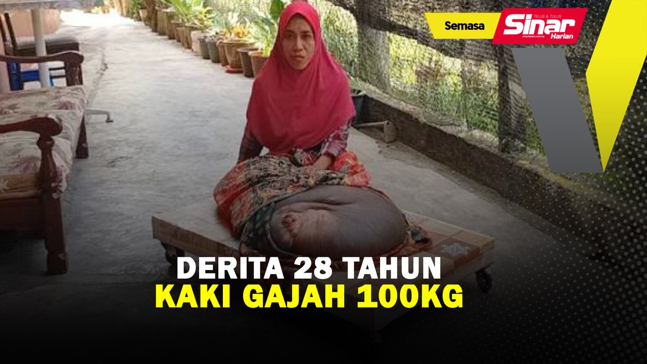 Derita 28 tahun kaki gajah 100kg