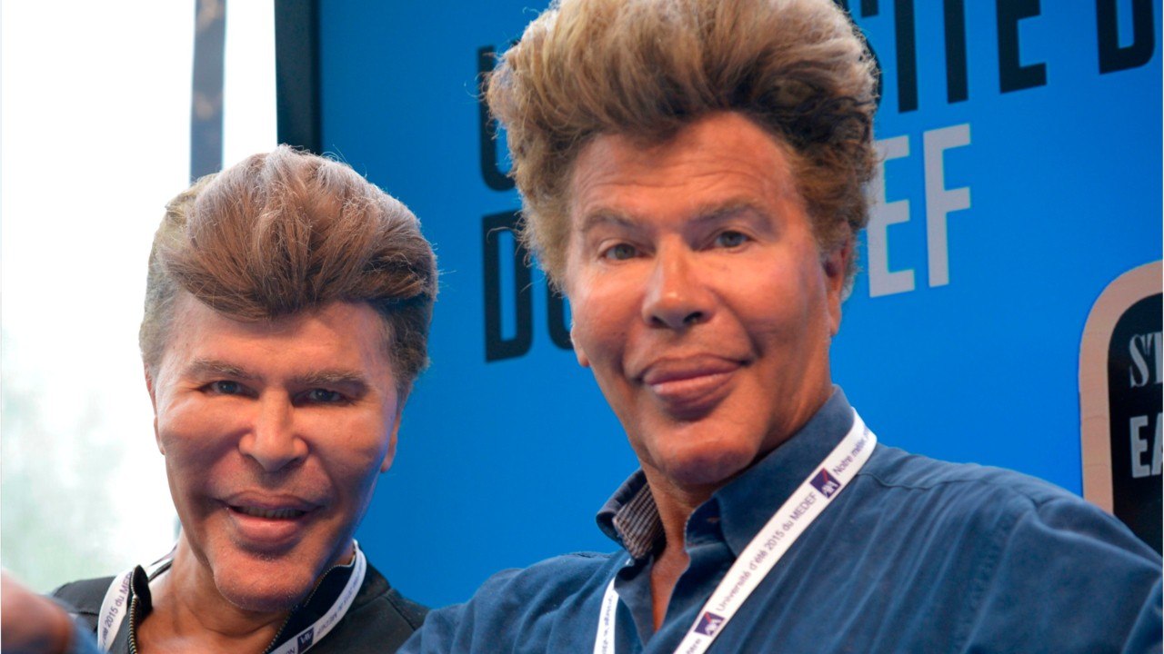 VOICI : Igor et Grichka Bogdanoff : Julie Jardon explique pourquoi Igor a fait de la chirurgie esthétique (1)