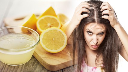 Hair में नींबू का रस लगाने पहले जरूर देखे Video, Scalp Infection से  लेकर Hair fall का खतरा| Boldsky