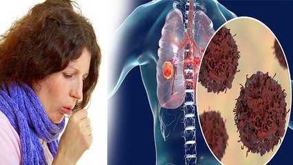 रात में खांसी आना इस गंभीर बिमारी के Symptoms पता लगने पर तुरंत कराए जांच | Boldsky
