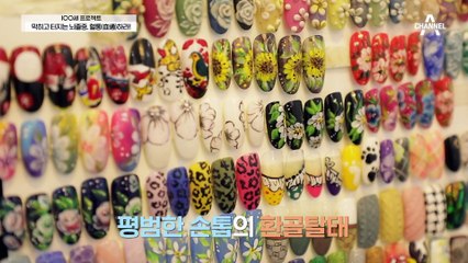 손발이 저리고, 다리가 붓고, 잦은 어지럼증은 고지혈증 의심증상이다?!