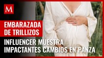 Influencer embarazada de trillizos muestra en fotos impactantes cambios en panza
