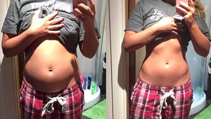 Tiffany Brien : cette blogueuse révèle une photo d'elle assez hallucinante pour parler de ses problèmes d'estomac