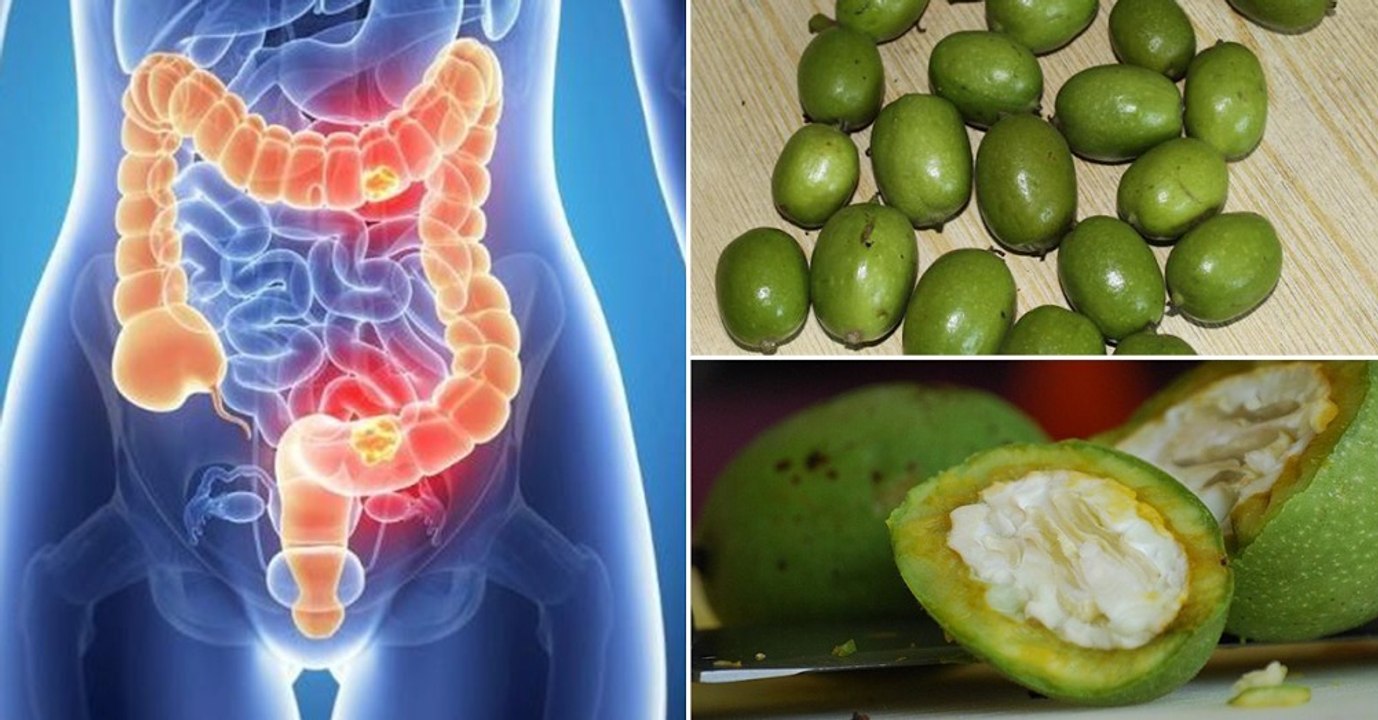 Une poignée de cet aliment chaque jour réduit le risque de cancer du côlon