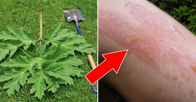 Si vous voyez cette plante dans votre jardin, ne la touchez surtout pas !