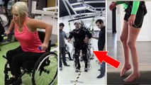 La technologie permet à des paraplégiques de retrouver partiellement le contrôle de leurs jambes