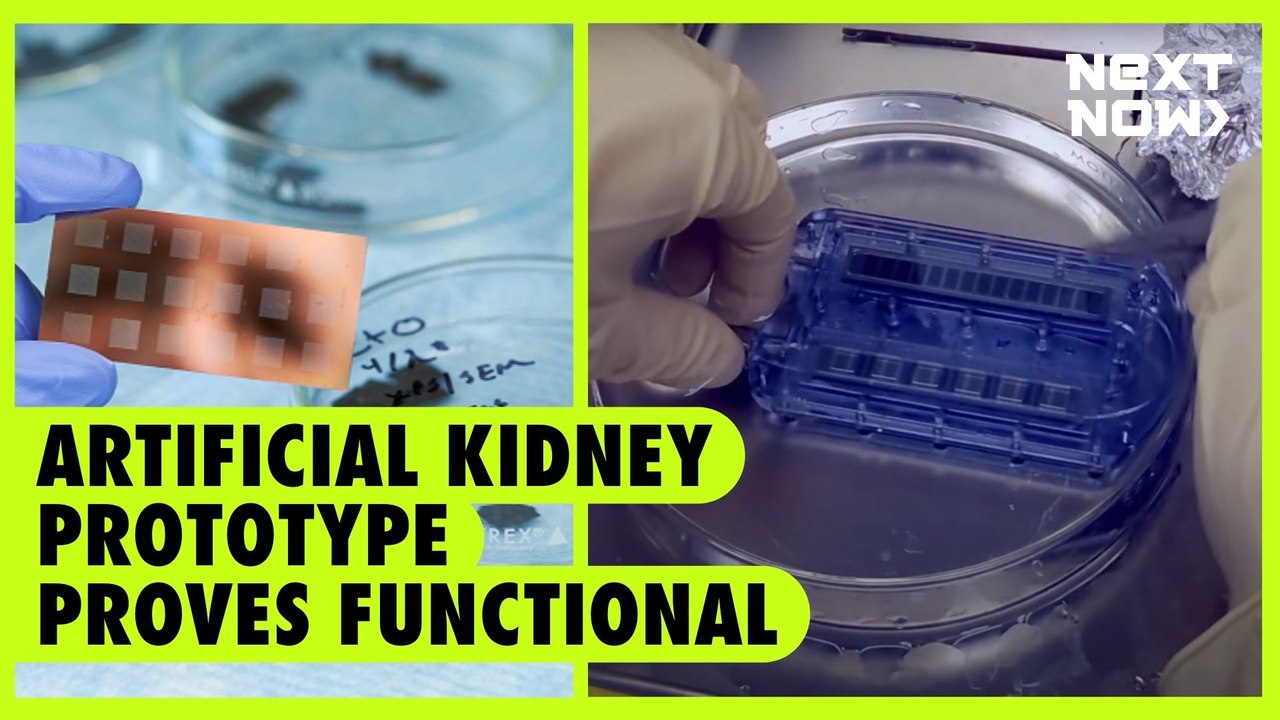 Artificial kidney prototype proves functional | NEXT NOW