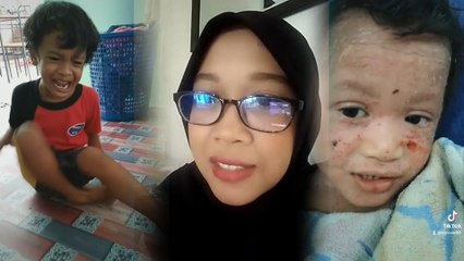 Besar dugaan ibu ini, dua anak hidap penyakit berbeza... Seorang autisme, seorang lagi ekzema kronik