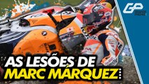 MARC MÁRQUEZ E O LONGO HISTÓRICO DE LESÕES NA MOTOGP
