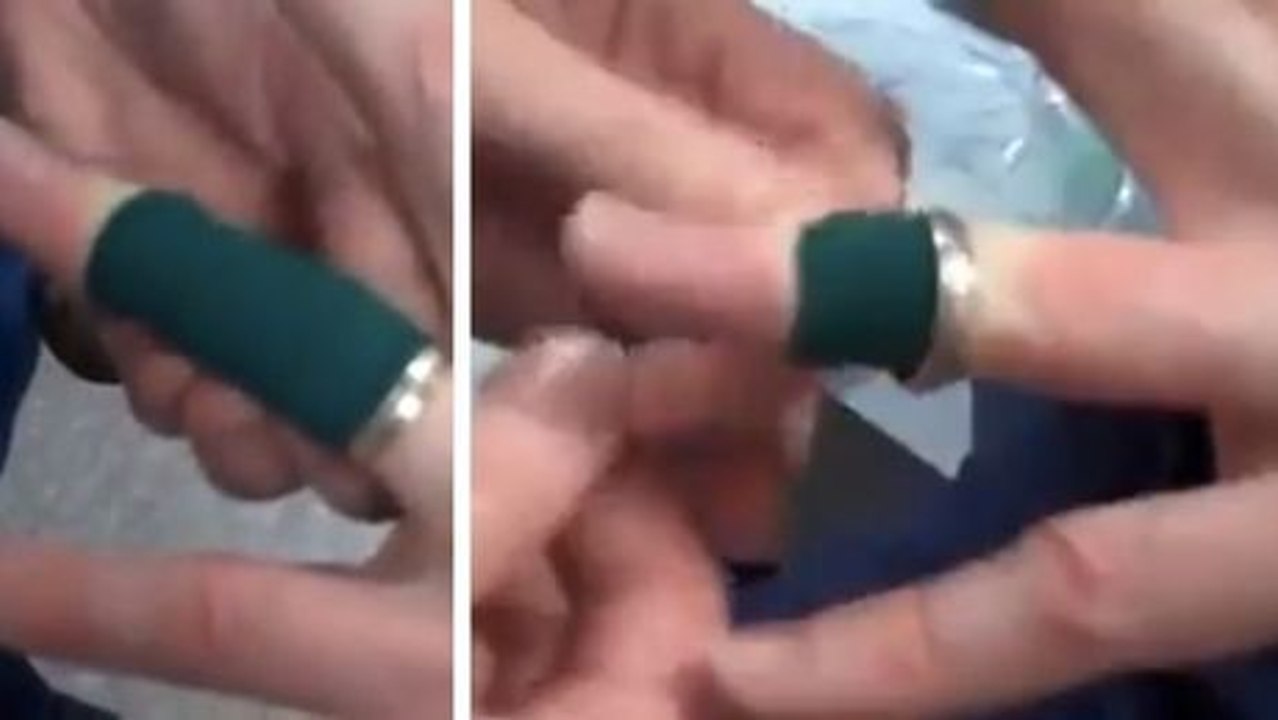 Entdecken Sie einen erstaunlichen Tipp, um einen am Finger festsitzenden Ring zu lösen.