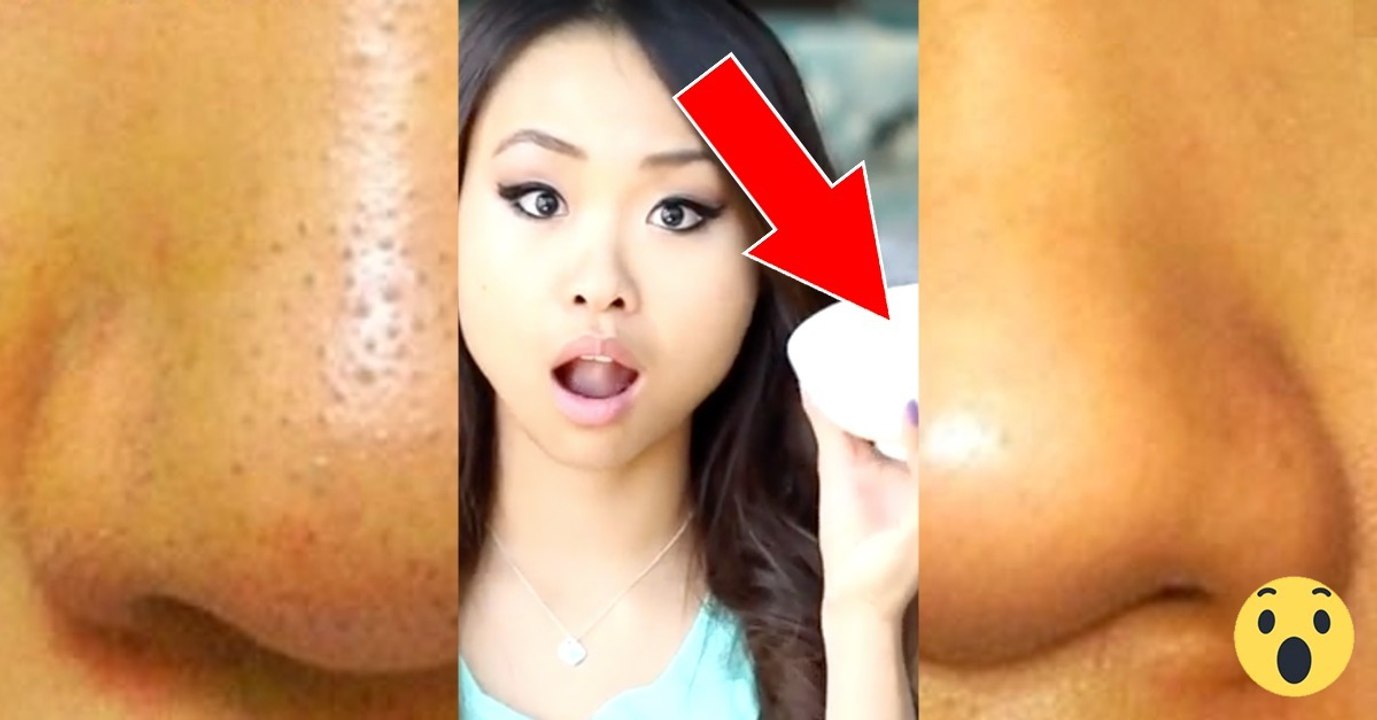 Die lösung, um mitesser loszuwerden: eiweiß