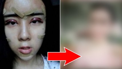 Sie legt sich mit 15 Jahren unters Messer, um ihren Ex zurückzuerobern