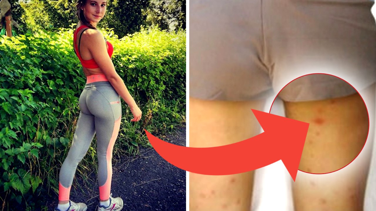 Warum Sie vorsichtig mit dem Tragen von Yogahosen sein sollten