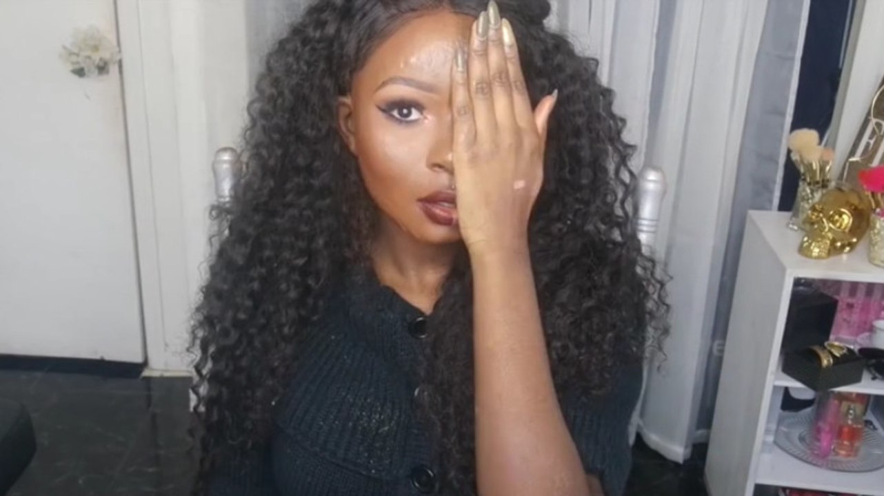 Im Gesicht schwer verbrannt, findet sie dank Make-up wieder Geschmack am Leben