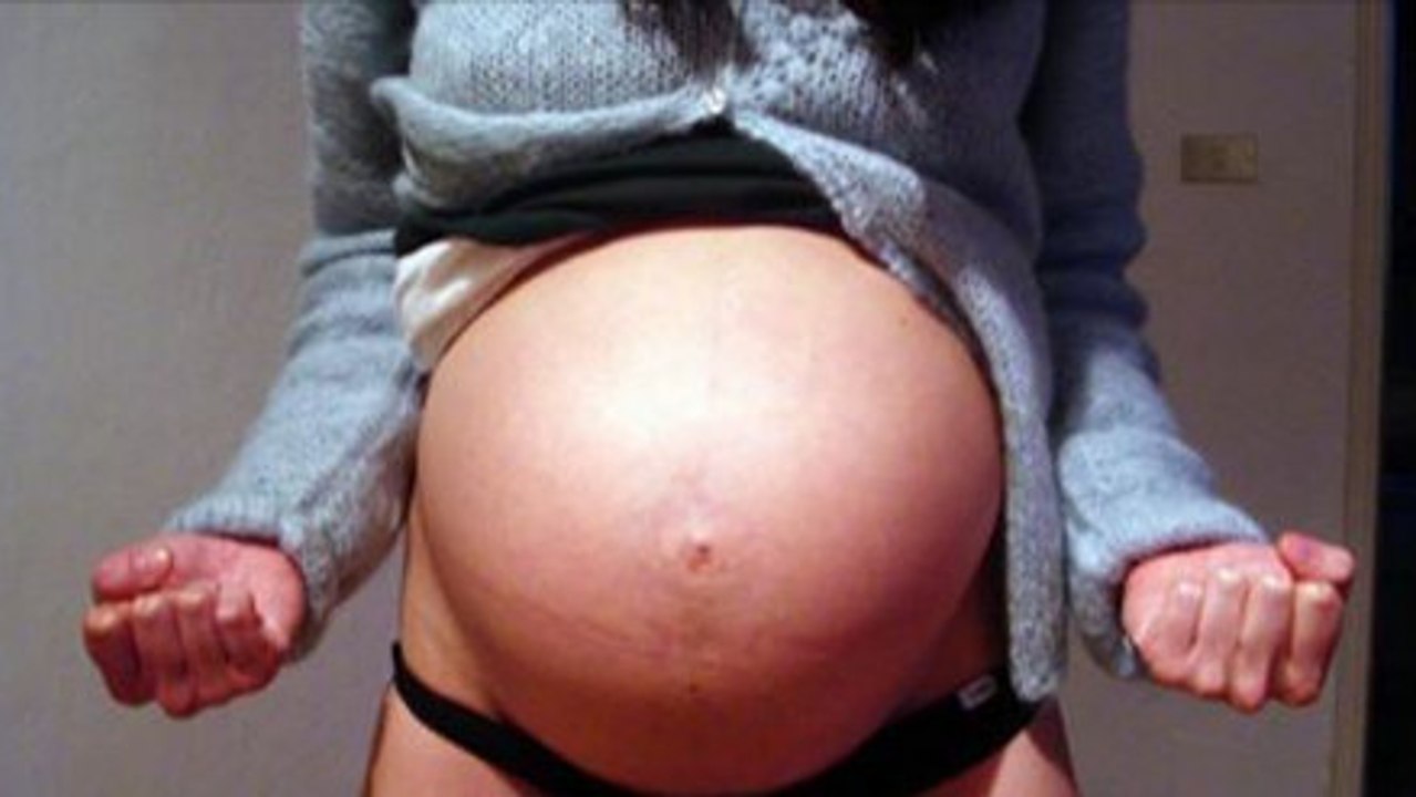 Diese Frau wusste nicht, was sie nach 10 Monaten Schwangerschaft erwartet!