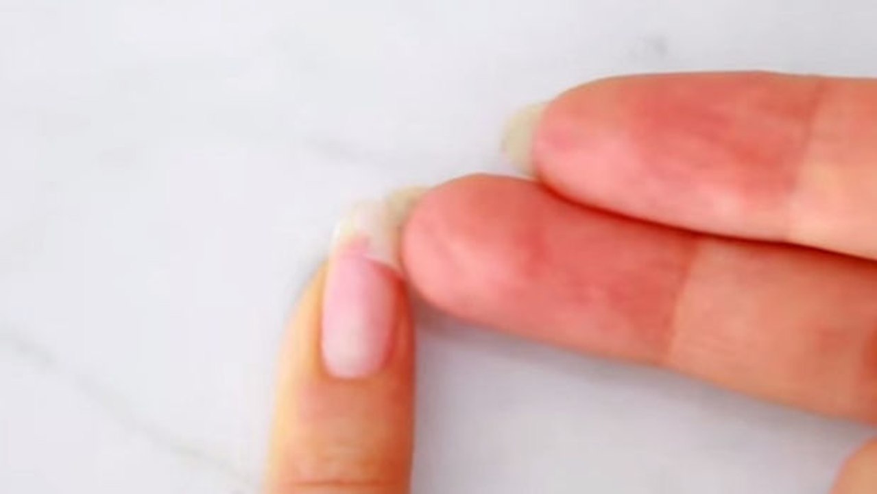 So einfach rettest Du einen eingerissenen Nagel... in nur wenigen Minuten