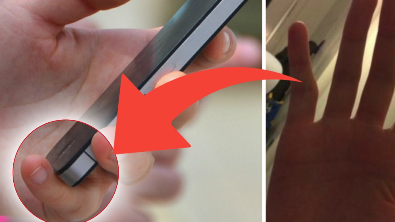 Kann zu intensives Benutzen von Smartphones Finger verformen?