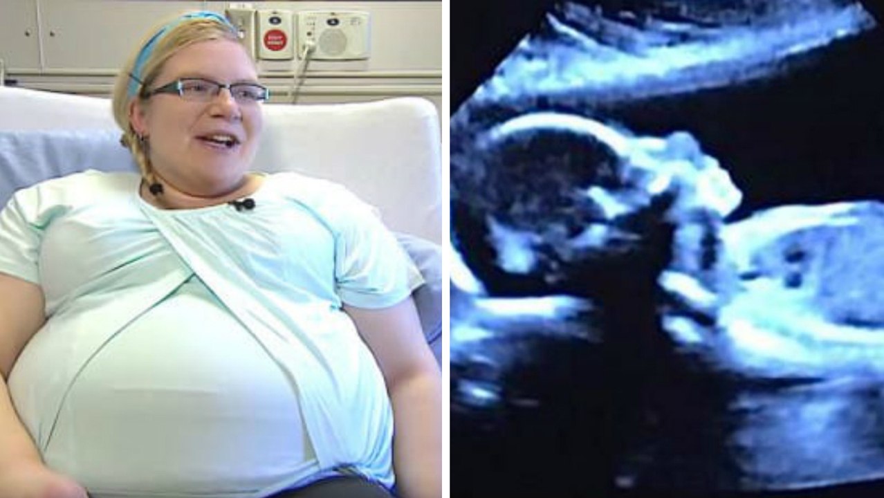 Mit der Ultraschallaufnahme kommt die große Überraschung: Diese werdende Mutter erwartet gleich vier Babys