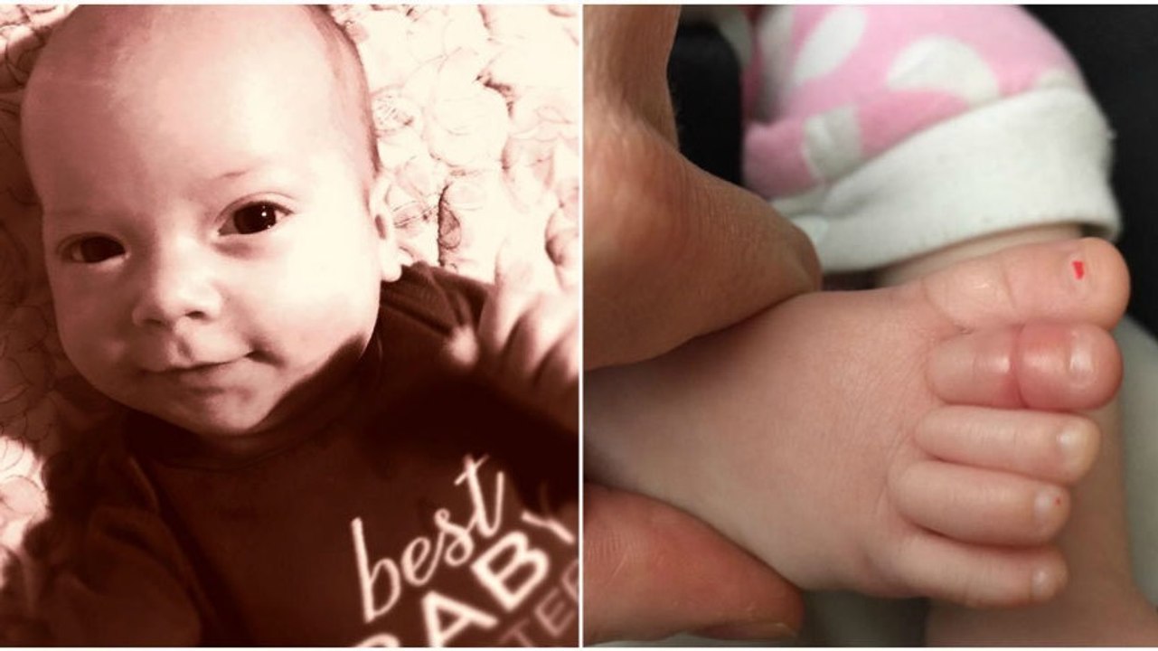 Tourniquet-Syndrom: Er veröffentlicht dieses Foto seines Babys als Warnung