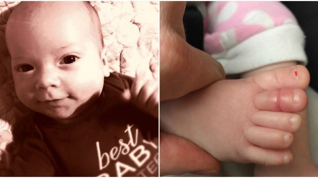 Tourniquet-Syndrom: Er veröffentlicht dieses Foto seines Babys als Warnung