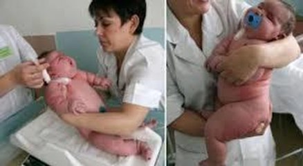 Dieses Baby ist das schwerste Baby der Welt und wiegt 18 Kilo!