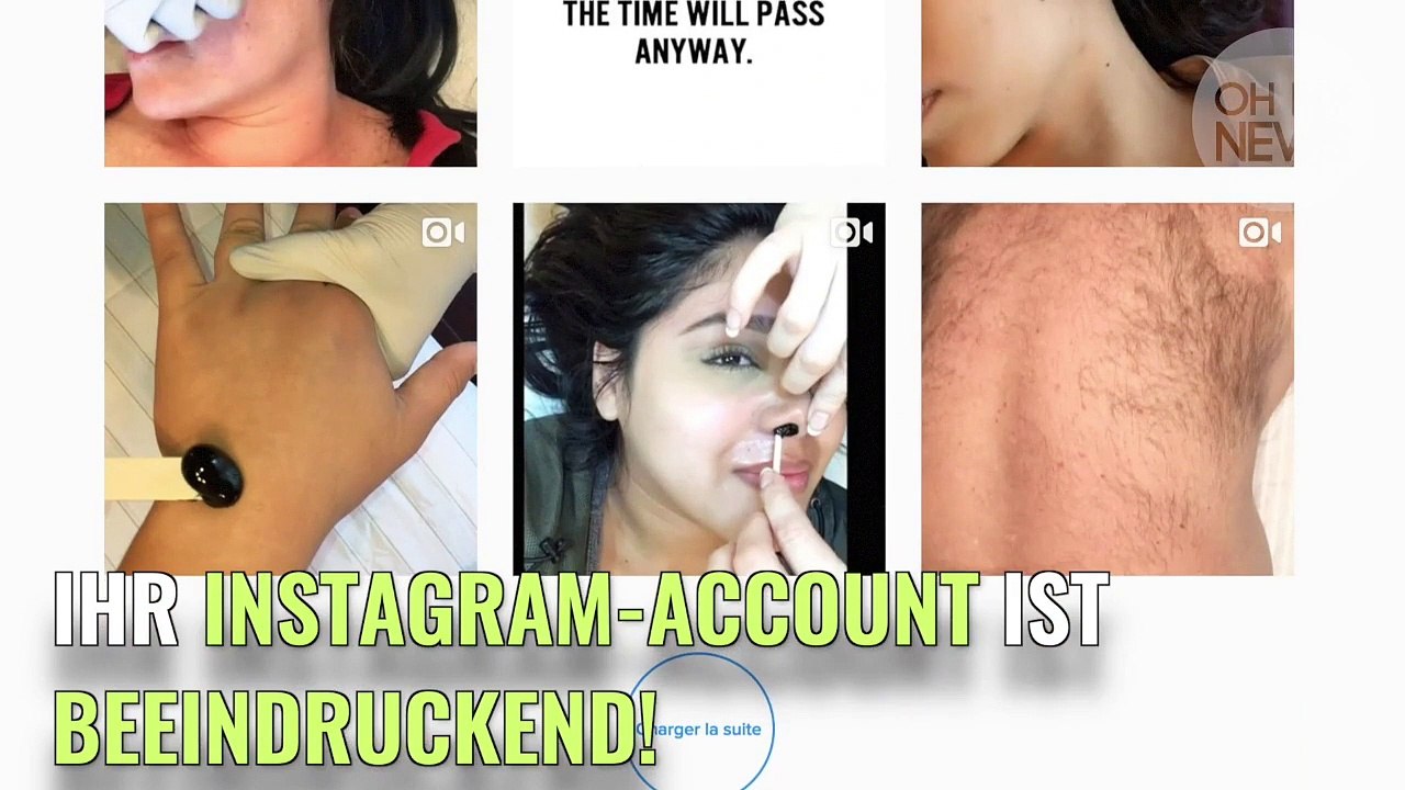 Liz Lugo fasziniert mit ihren Enthaarungsvideos