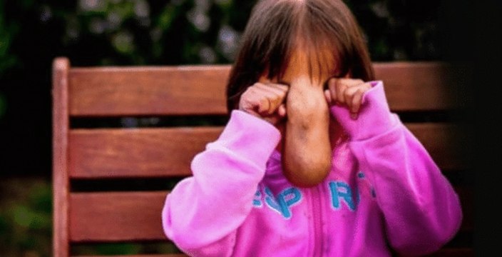 Mädchen leidet sehr unter ihrem Gesicht. Doch heute ist sie wie verwandelt!