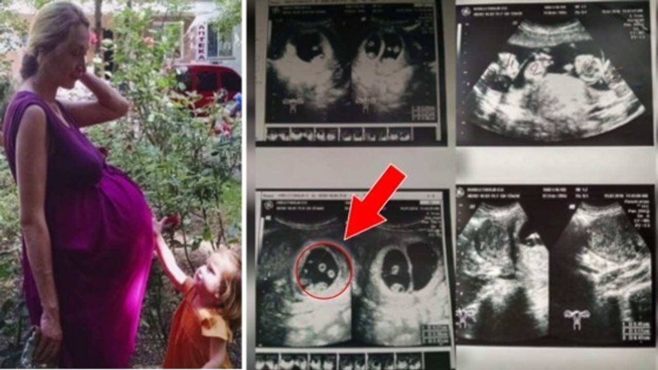 Diese Frau erwartet ihr viertes Kind. Was sie auf dem Ultraschall entdeckt, ist allerdings ein Schock!