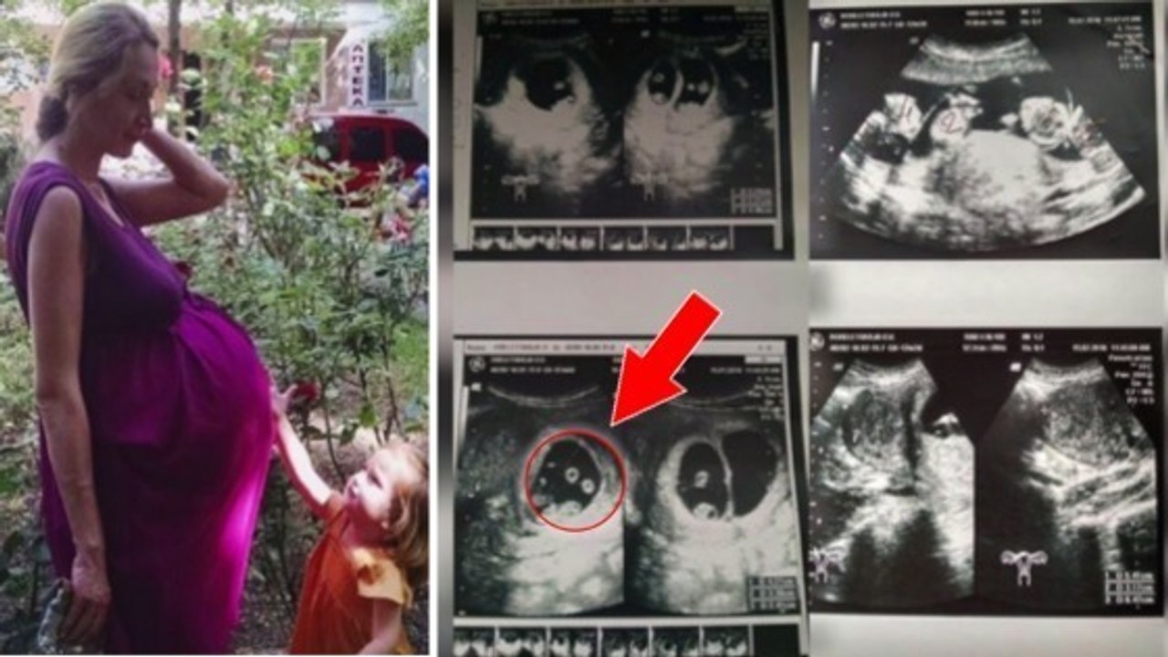 Diese frau erwartet ihr viertes kind. was sie auf dem ultraschall entdeckt, ist allerdings ein schock!