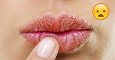 Ursache für trockene Lippen: Zahnpasta